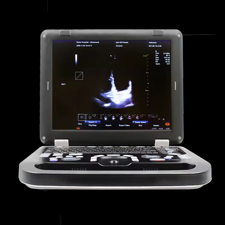 JYTOP CMS1700C Color Doppler Ultrasonic Diagnostic System Usg Machine