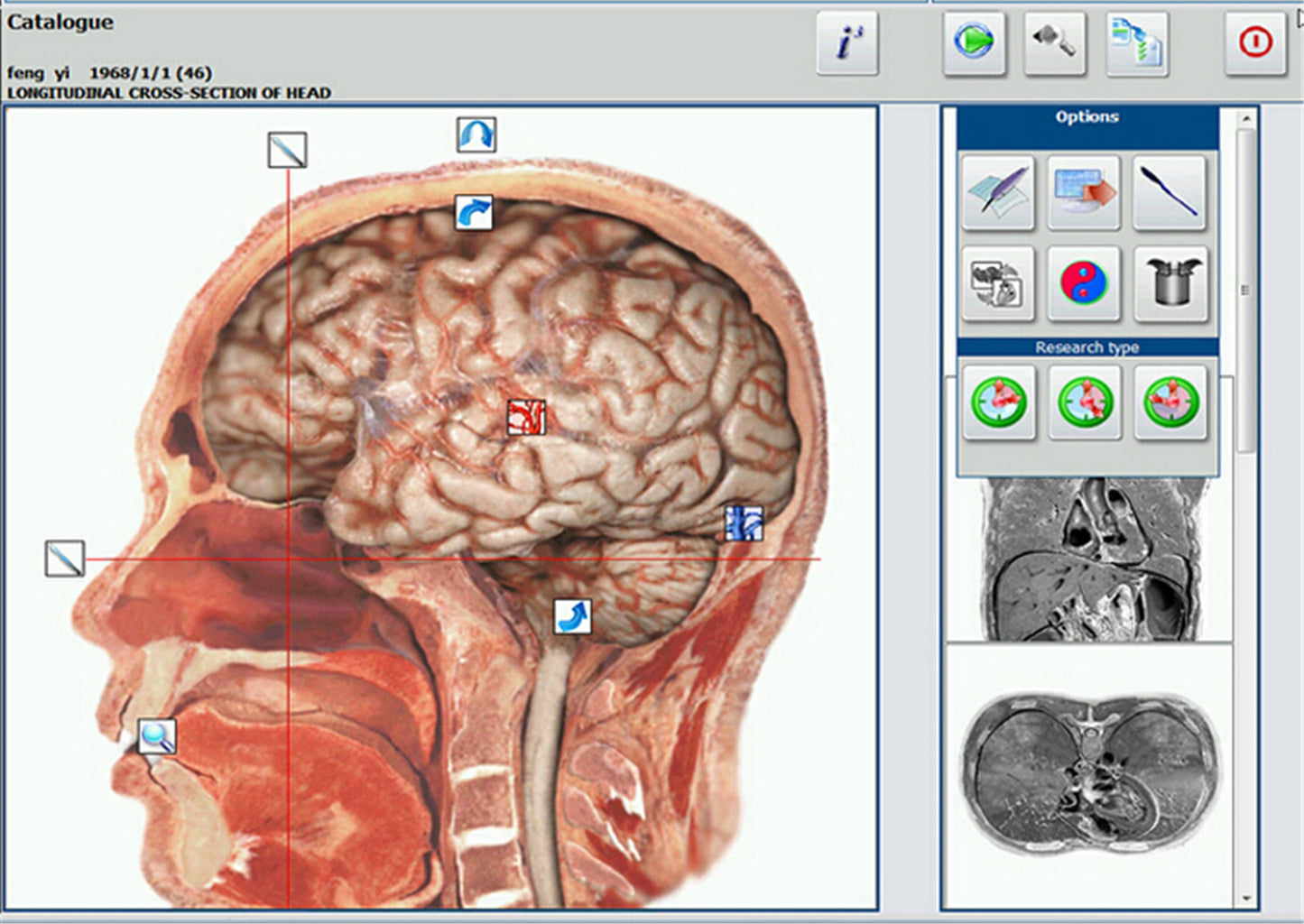 JYTOP New Bio Resonance system Hunter 18D 4025 NLS with Computer