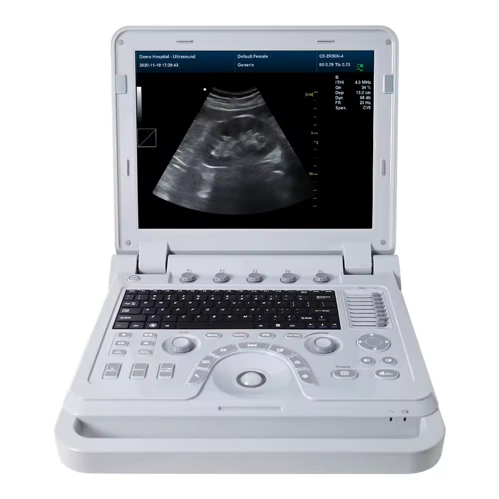 JYTOP CMS600P2 Plus Promotion Portable CE 12.1 Inch Color Convex Ultrasound Scanner