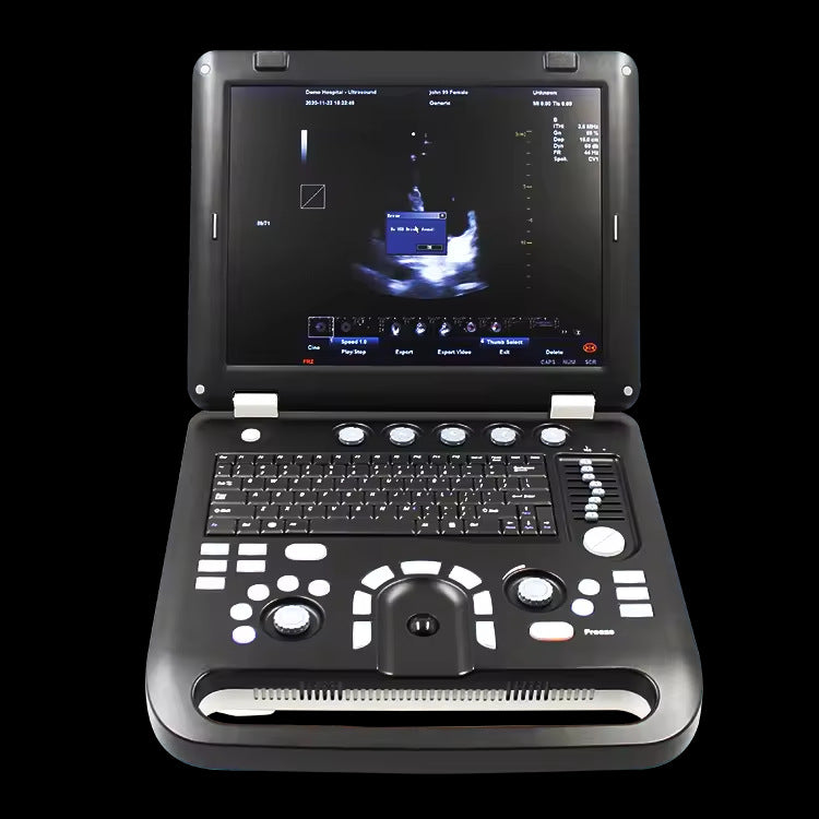 JYTOP CMS1700C Color Doppler Ultrasonic Diagnostic System Usg Machine