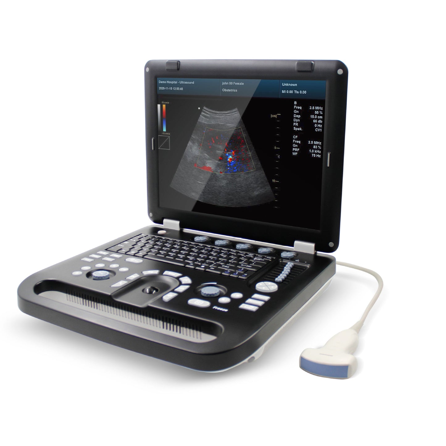JYTOP CMS1700C Color Doppler Ultrasonic Diagnostic System Usg Machine