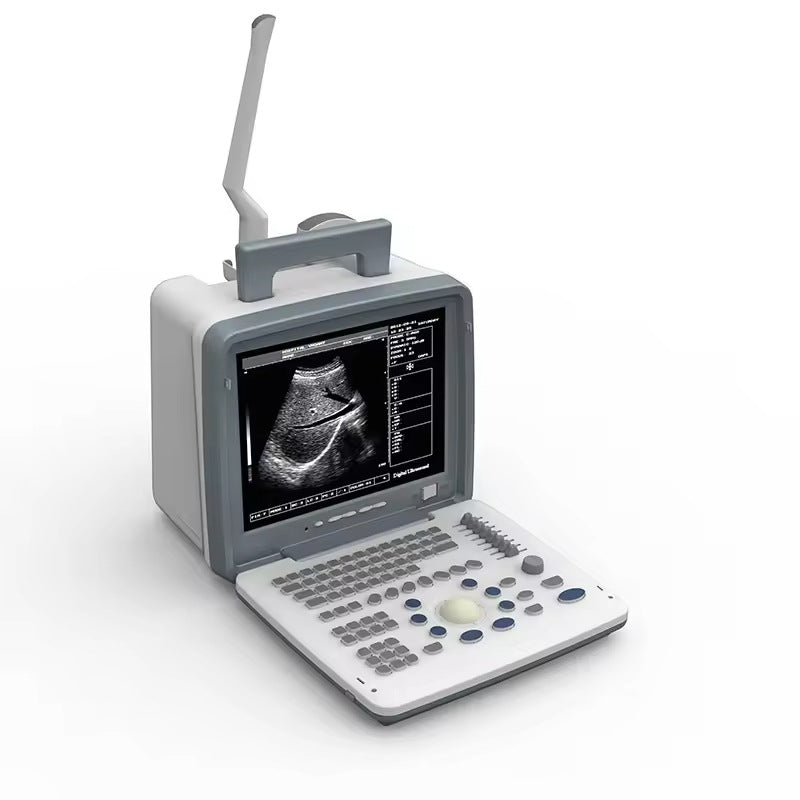 JYTOP Convex Probe Pregnancy Laptop LED Digital B/W Doppler Medical