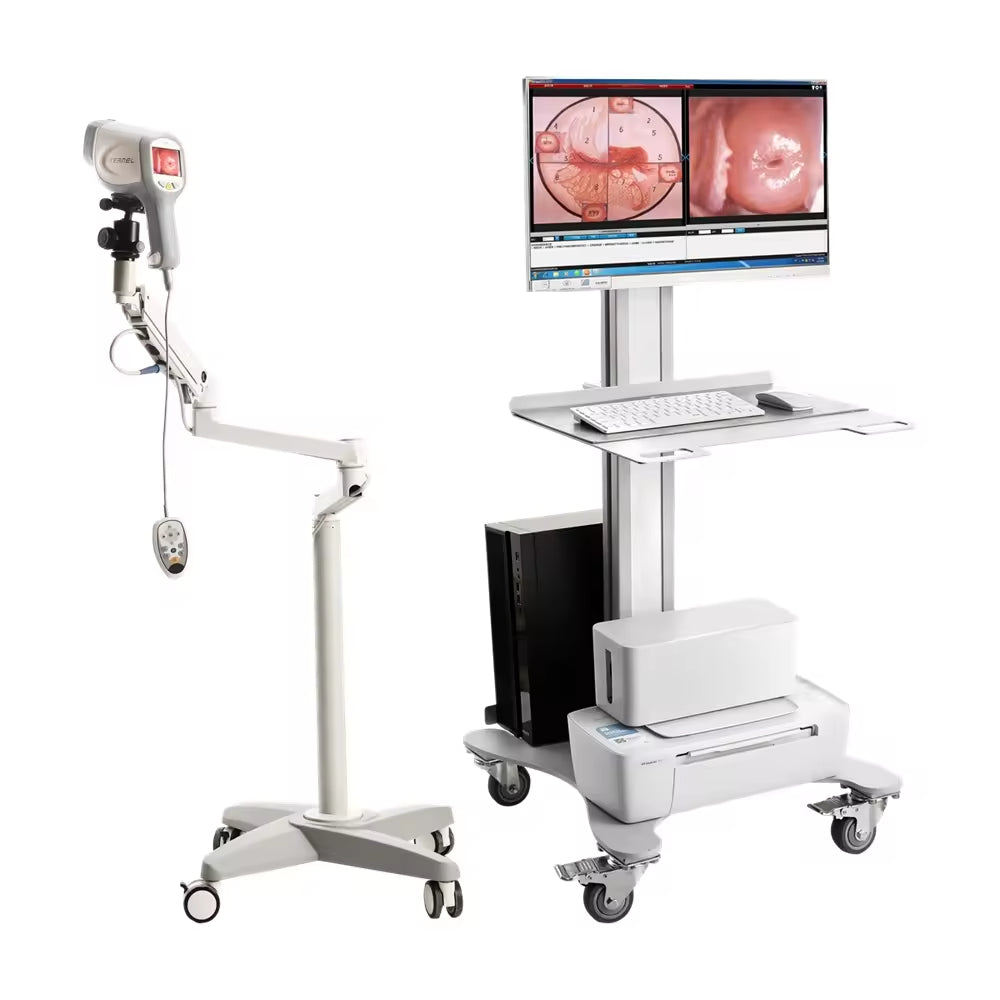JYTOP KN-2200A HD Digital Video Colposcope Gynecology Examination Equipment