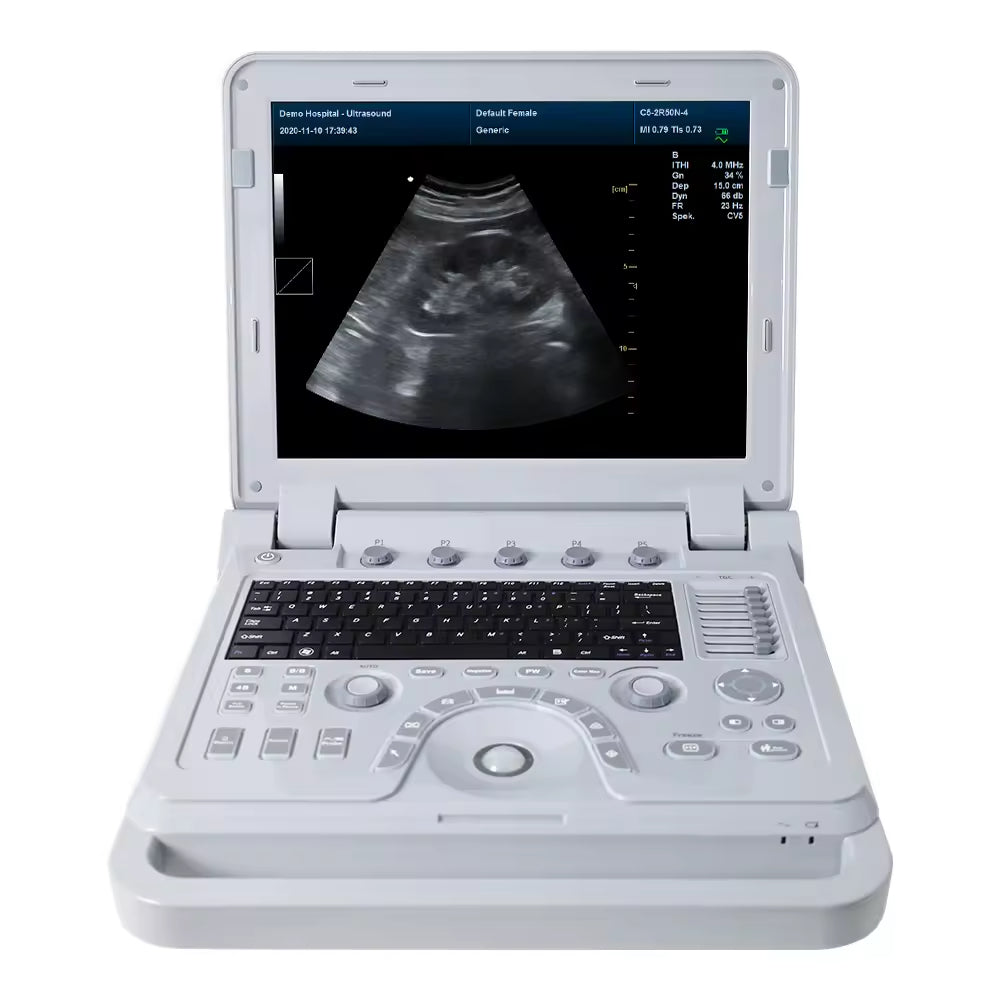 CMS600P2plus VET Color Doppler Ultrasound Machine Veterinary Ultrasound System