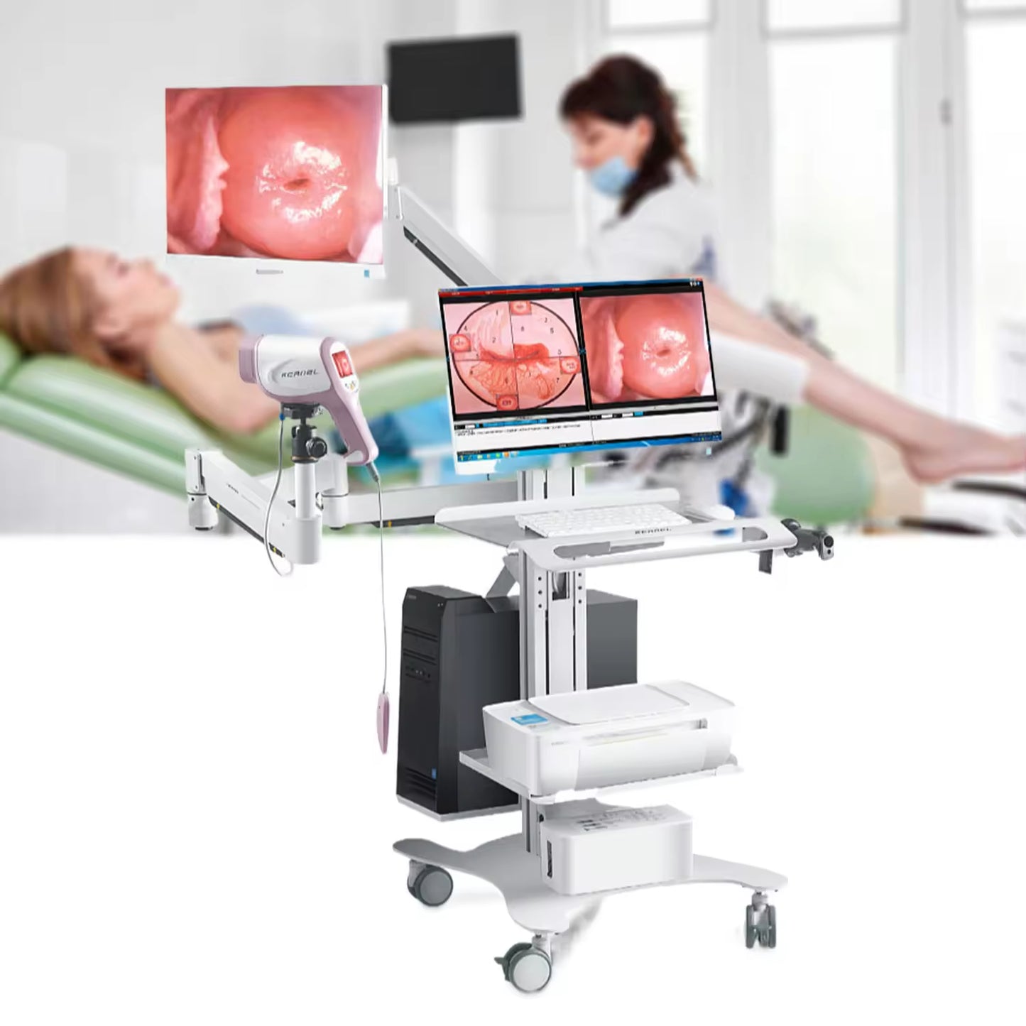 JYTOP KN2200I HD CCD Camera Digital Video Kernel Optic Colposcope for Gynecology Colposcopy with Software