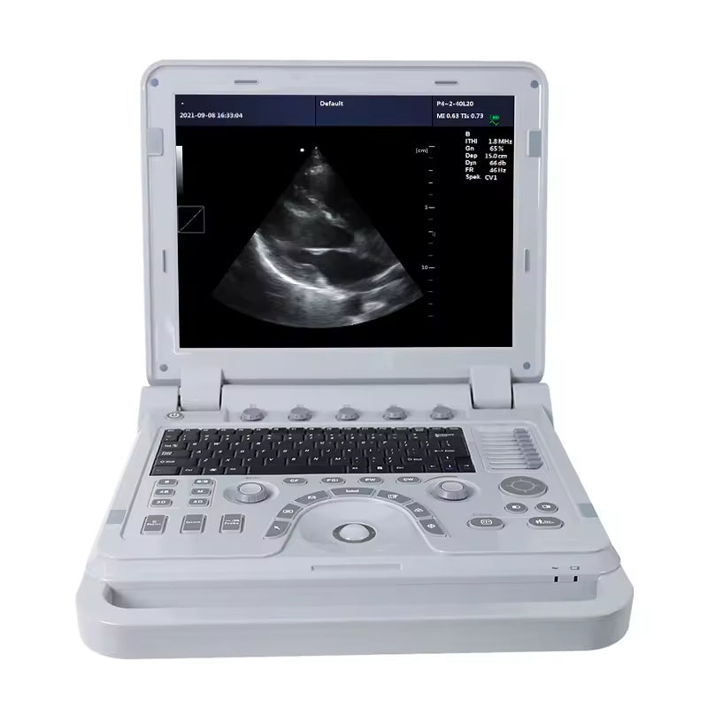 JYTOP CMS1700A Factory Portable Ultrasound Machine Ultrasound System Color Doppler Ultrasonic Diagnostic Device