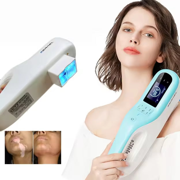 JYTOP KN-5000E Portable XeCl 308nm Excimer Laser Phototherapy Device for Psoriasis Vitiligo Targeted Treatment