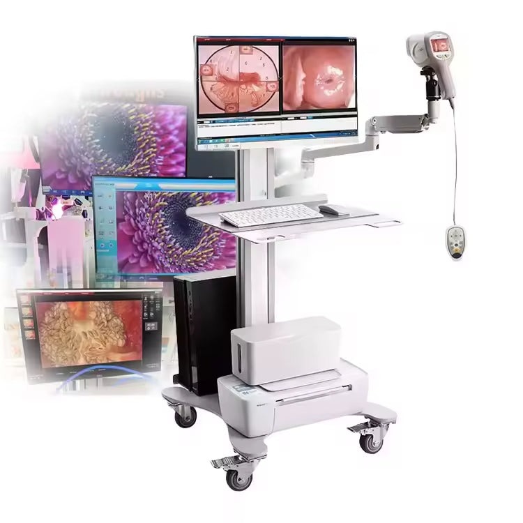 JYTOP KN-2200I H Full HD Gynecological Digital Video Colposcope Equipment With Optional Two Screens