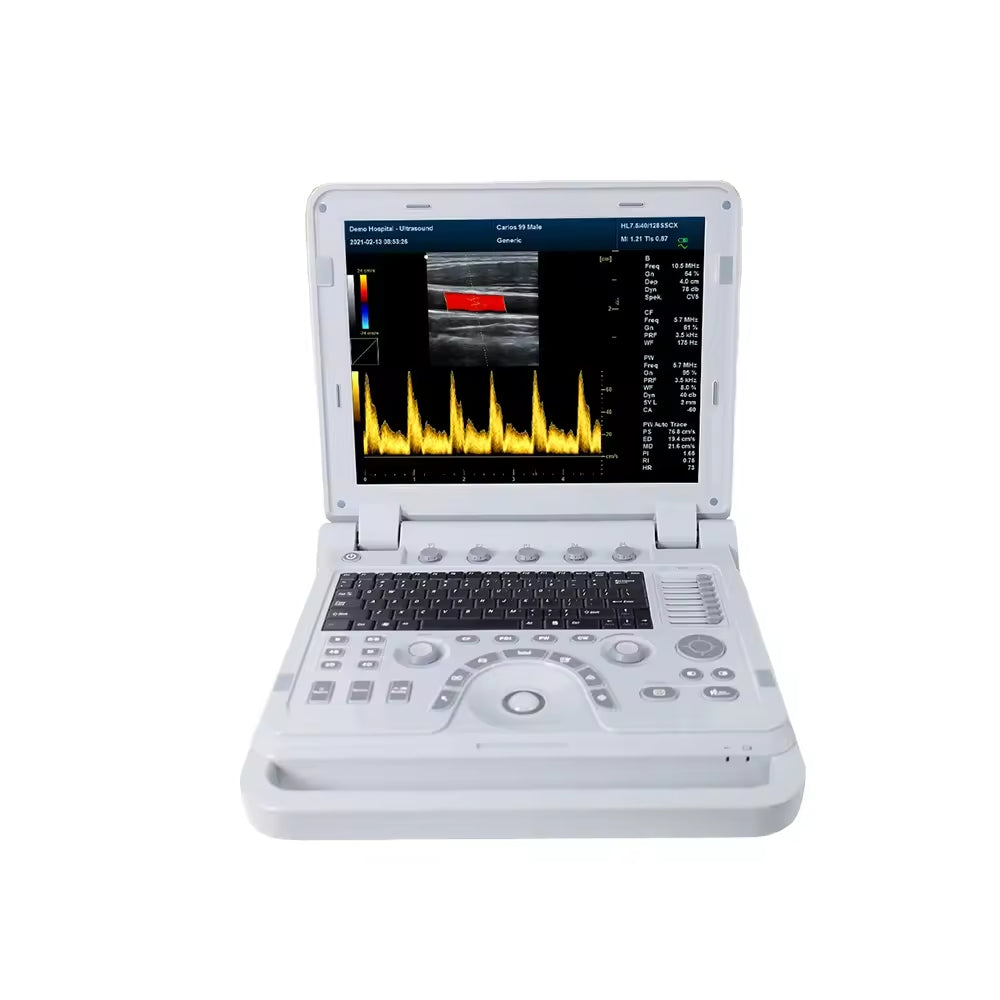 CMS1700B-VET Portable Vet Ultrasonic Scanner Veterinary Ultrasound Bovine