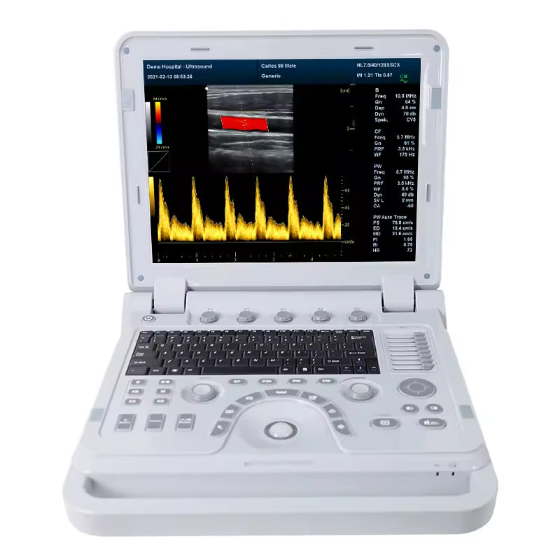 JYTOP CMS1700B Body Ultrasound Cardiology Ultrasound Cbaby Ultrasound Machine