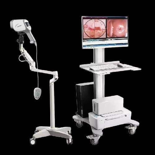 JYTOP KN 2200A 2.1MP Gynecological Colposcope Diagnostic Apparatus Colposcopy Machine for Vulva Examination