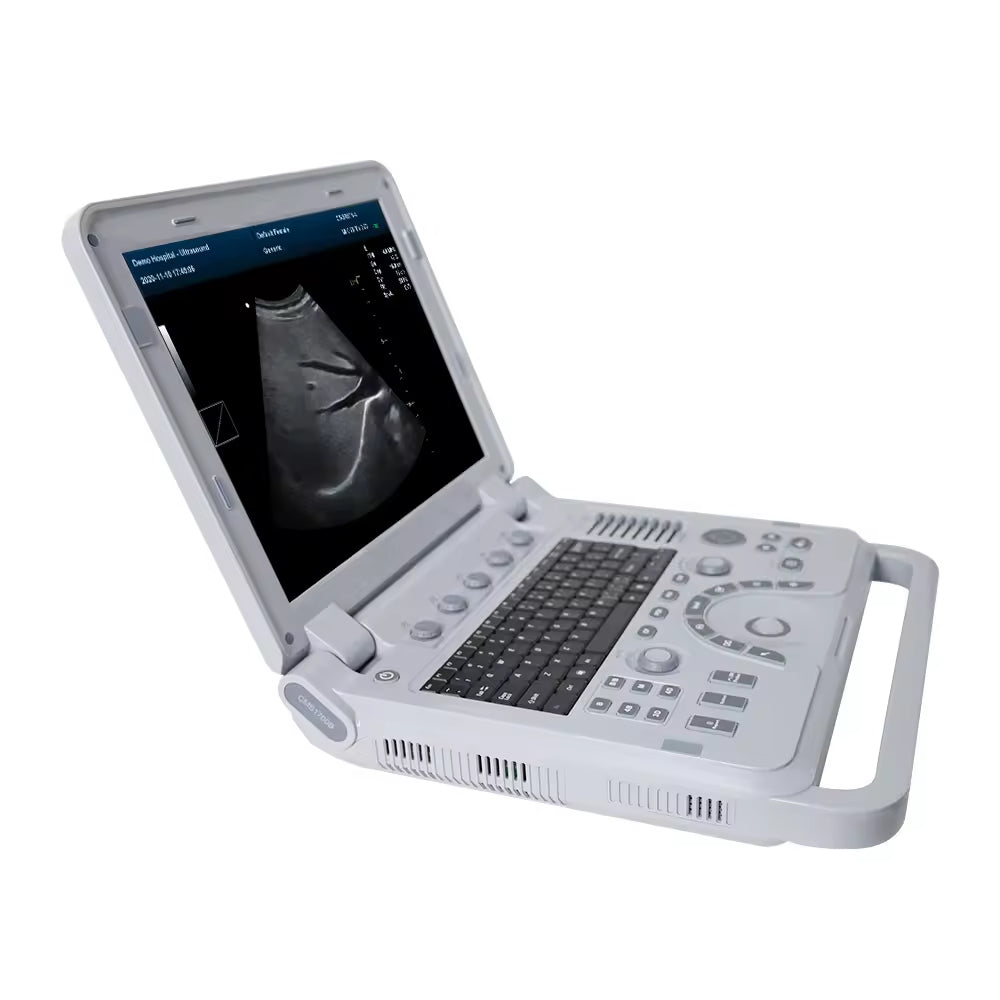 JYTOP CMS1700A Factory Portable Ultrasound Machine Ultrasound System Color Doppler Ultrasonic Diagnostic Device