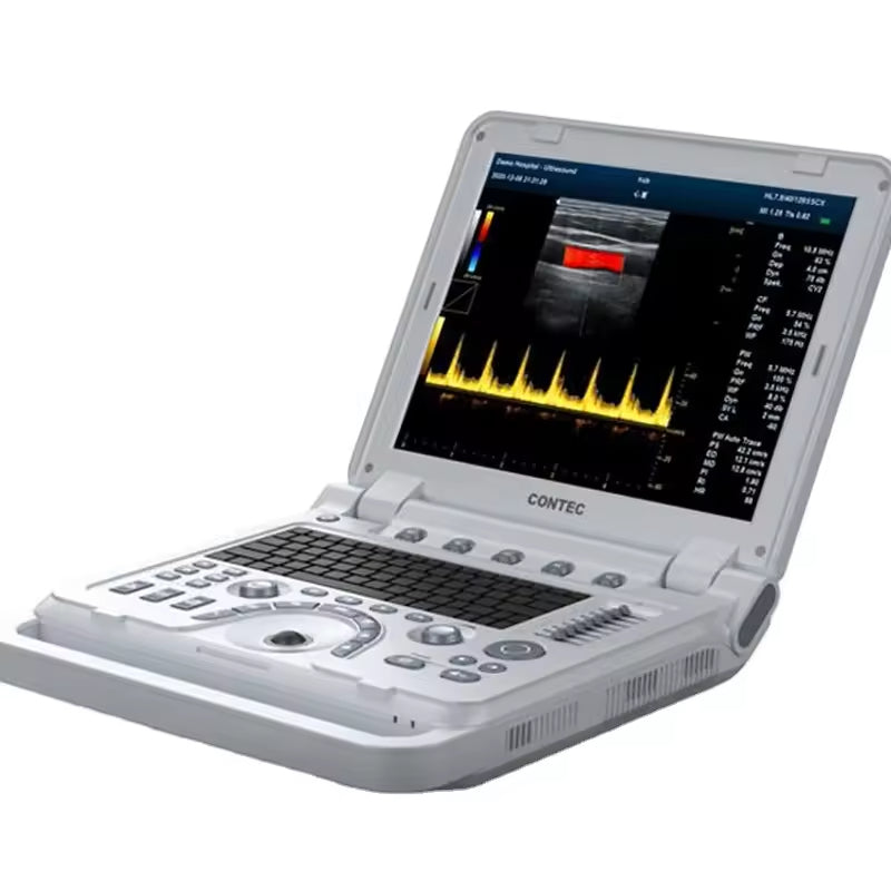 JYTOP CMS1700B Body Ultrasound Cardiology Ultrasound Cbaby Ultrasound Machine