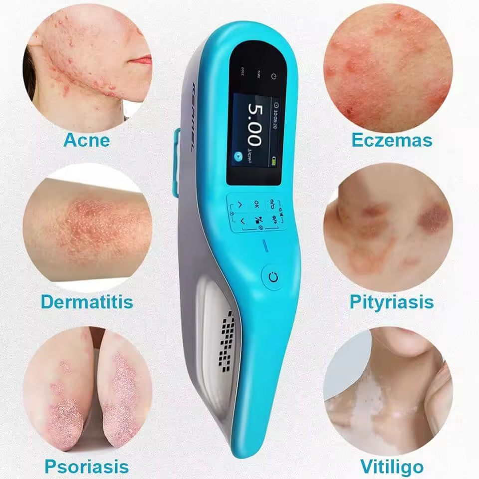 JYTOP KN-5000E Portable XeCl 308nm Excimer Laser Phototherapy Device for Psoriasis Vitiligo Targeted Treatment