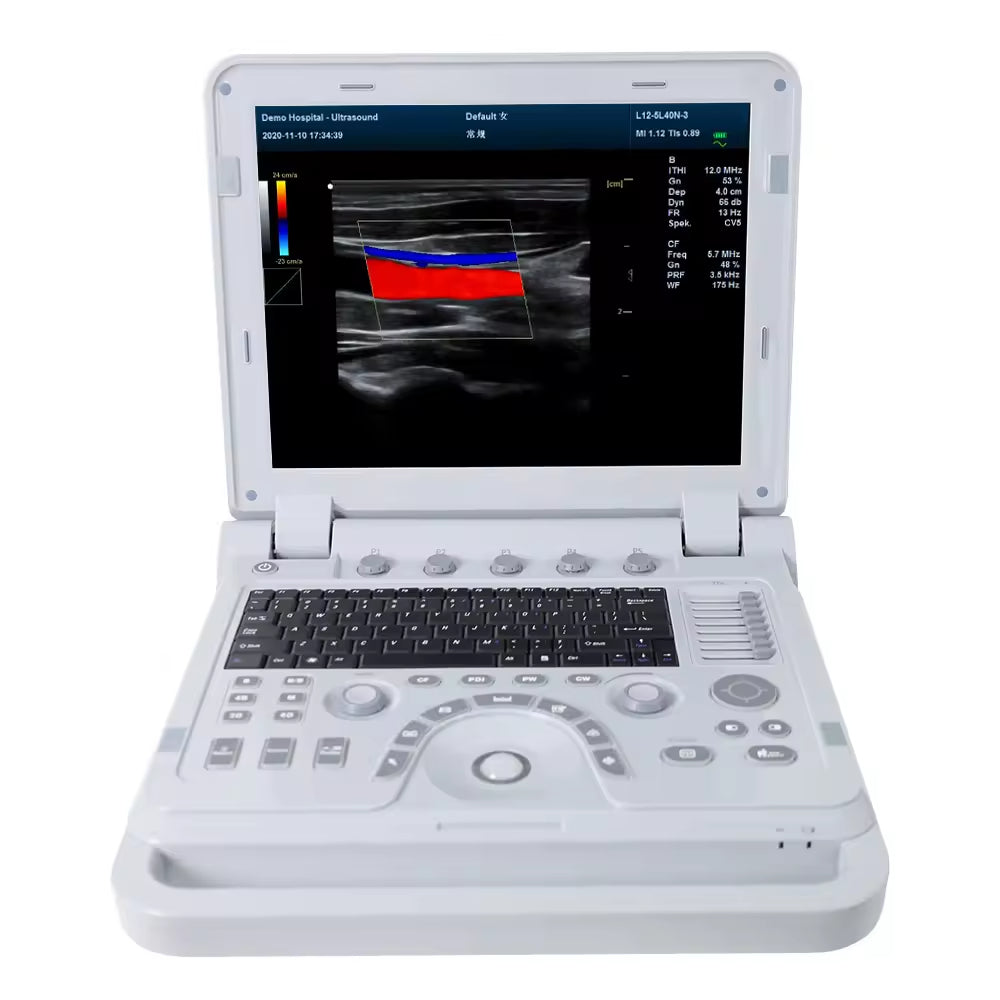 JYTOP CMS1700A Factory Portable Ultrasound Machine Ultrasound System Color Doppler Ultrasonic Diagnostic Device