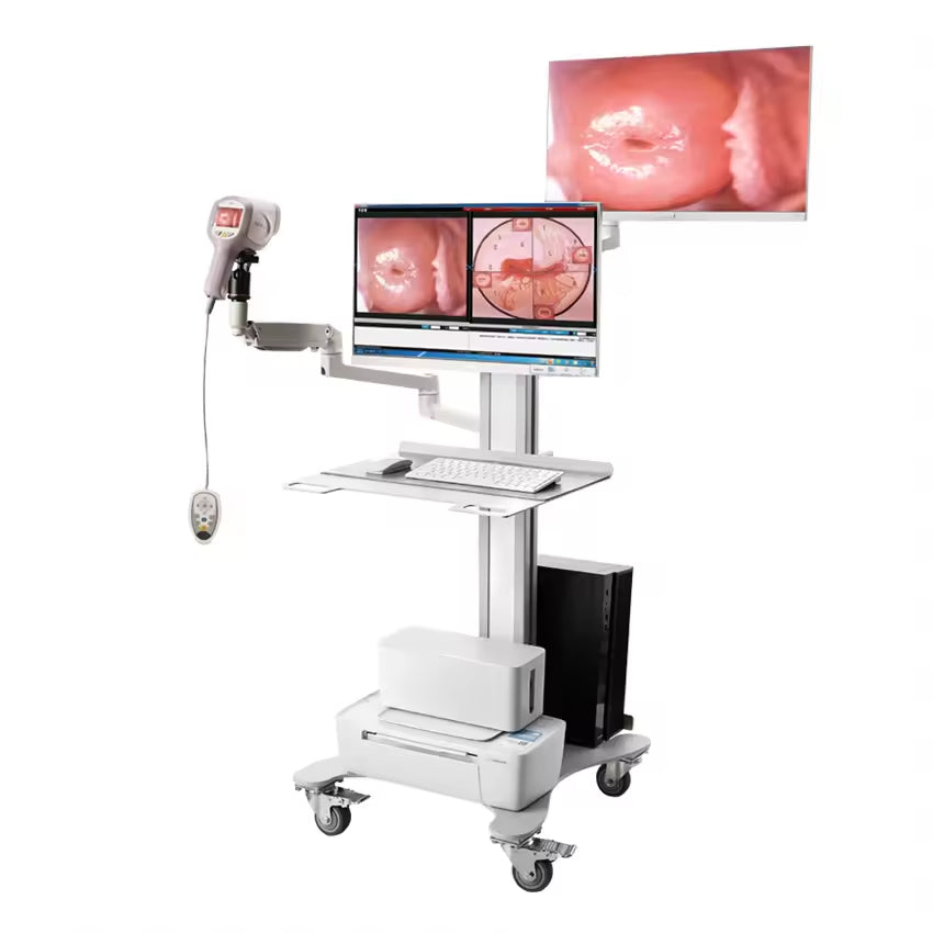 JYTOP KN-2200I H Full HD Gynecological Digital Video Colposcope Equipment With Optional Two Screens