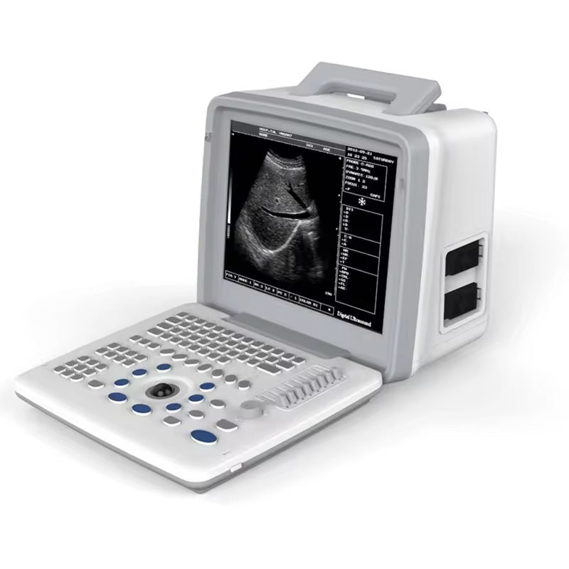 JYTOP Convex Probe Pregnancy Laptop LED Digital B/W Doppler Medical