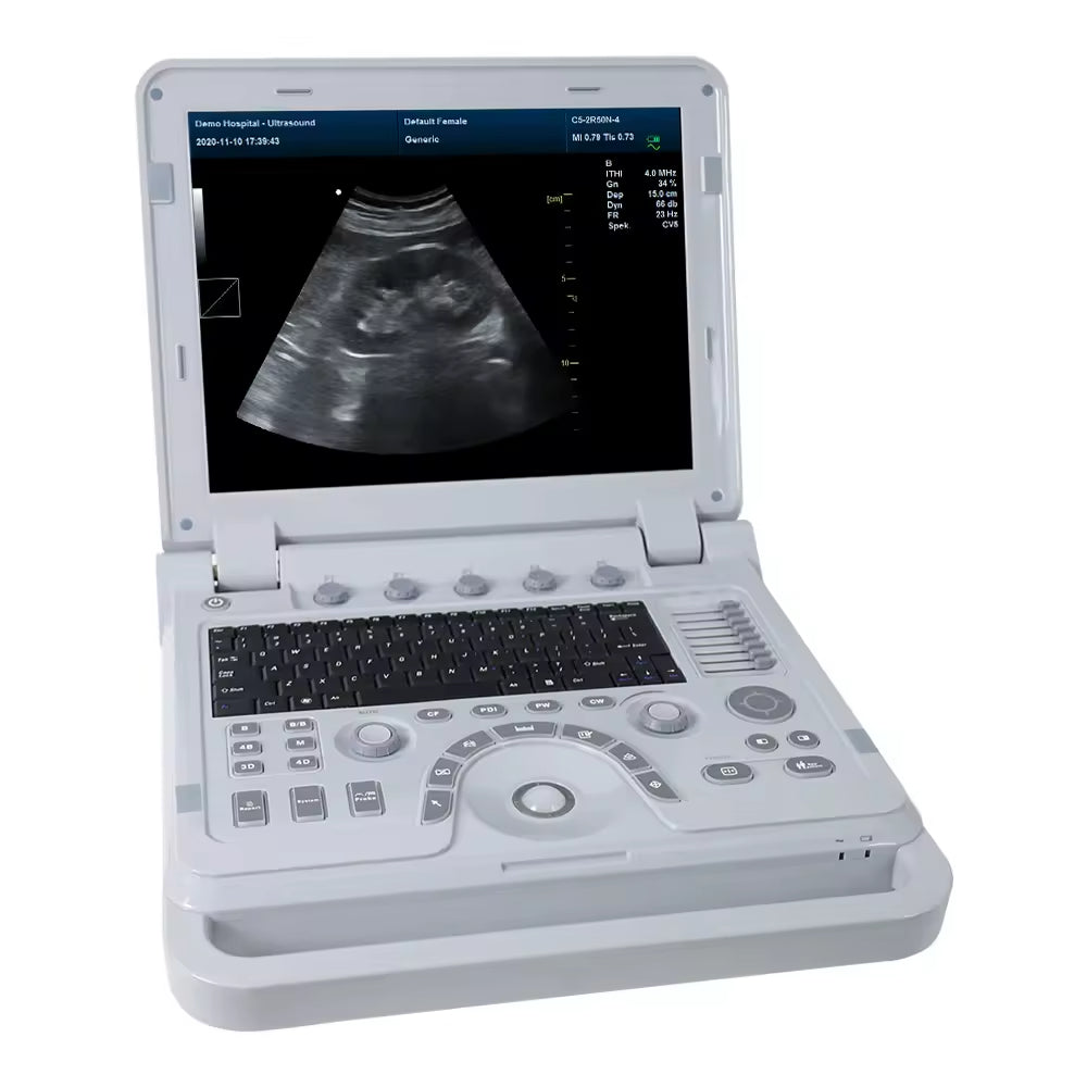 CMS1700B-VET Portable Vet Ultrasonic Scanner Veterinary Ultrasound Bovine