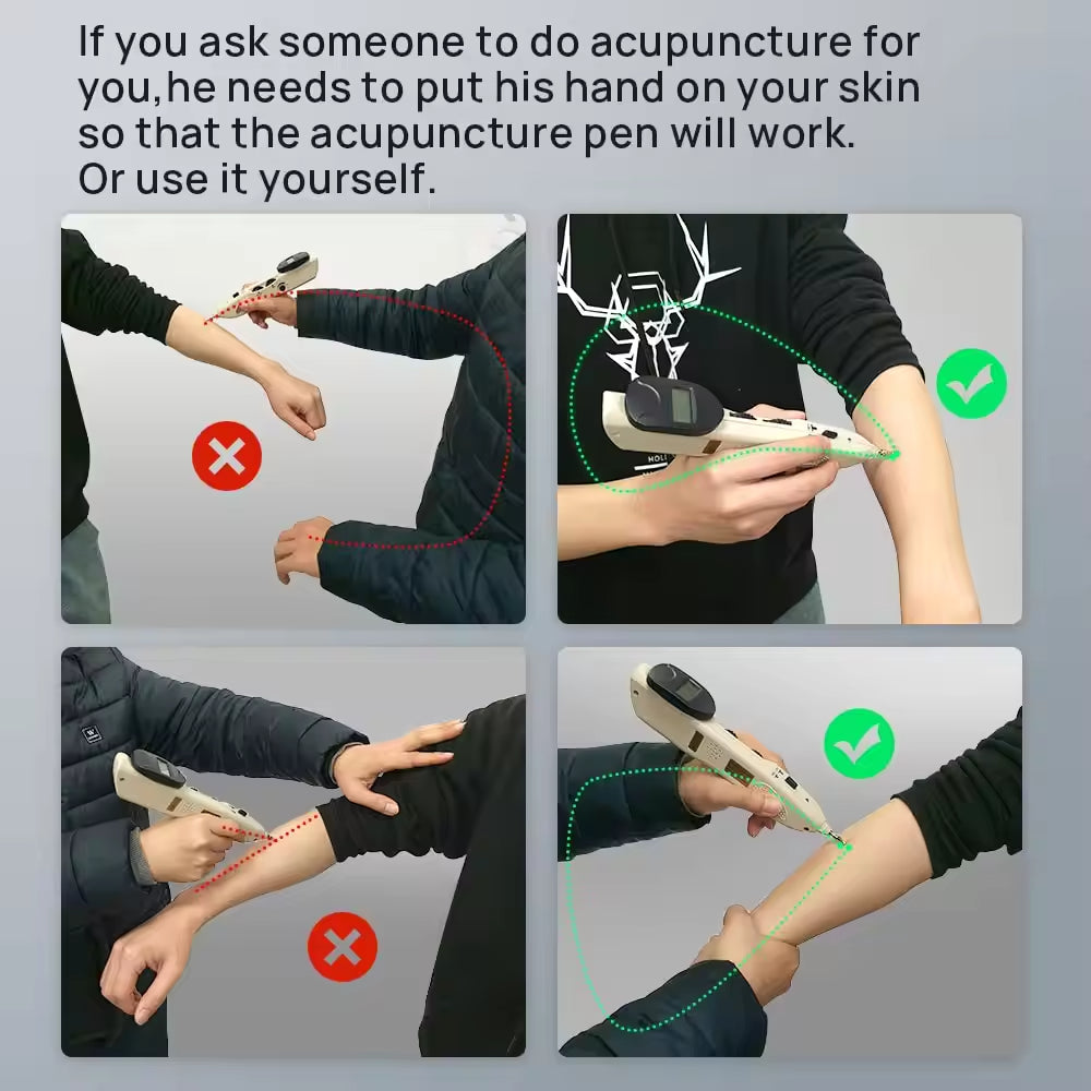 JYTOP Electroacupuncture Device Magnetic Accupressure Therapy Pain Massage Gone Pen Acupuncture Point Locator Pencil