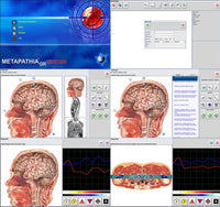 JYtop Metapathia GR Hunter 18D 4025 NLS Diagnose Bioresonanz Therapie evtl m Laptop Biosca