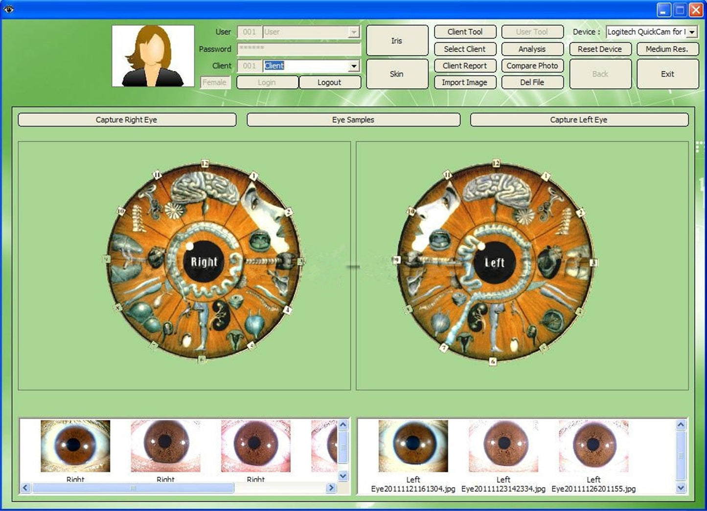 JYtop NEW 5.0 MP USB Eye Iriscope,Iris Iridology camera 990U with Pro Software, FCC,CE EH990U