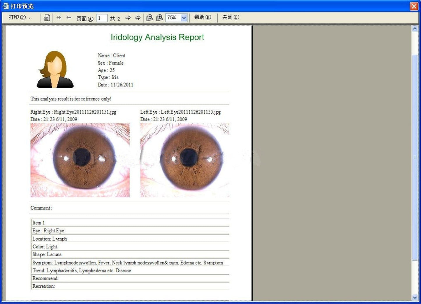 JYtop NEW 5.0 MP USB Eye Iriscope,Iris Iridology camera 990U with Pro Software, FCC,CE EH990U