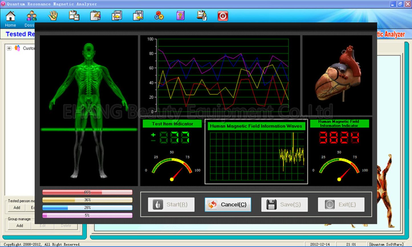 JYtop Quantum Magnetic Resonance Analyzer With English And Spanish version software