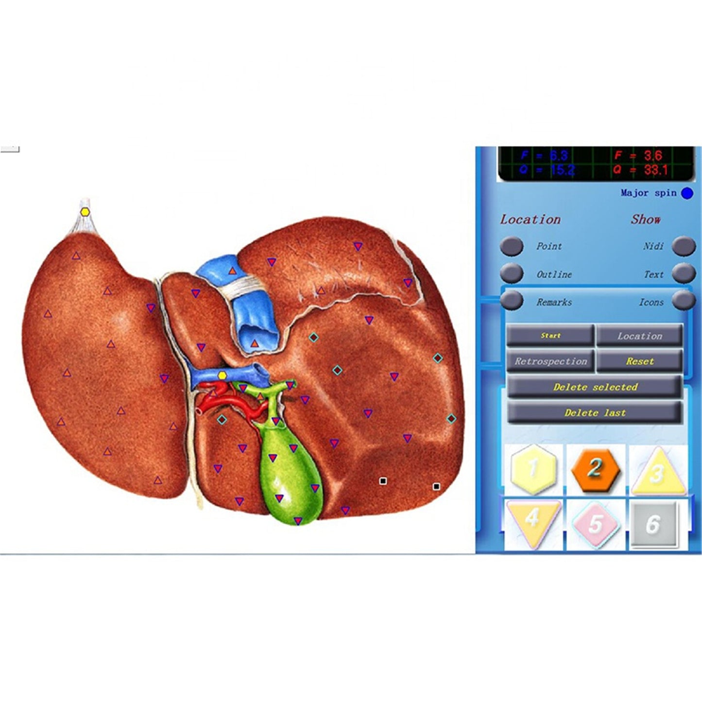 JYTOP Latest 3D-Cell Diagnostics Sub Health Analyzer Quantum Bioresonance Analyzer