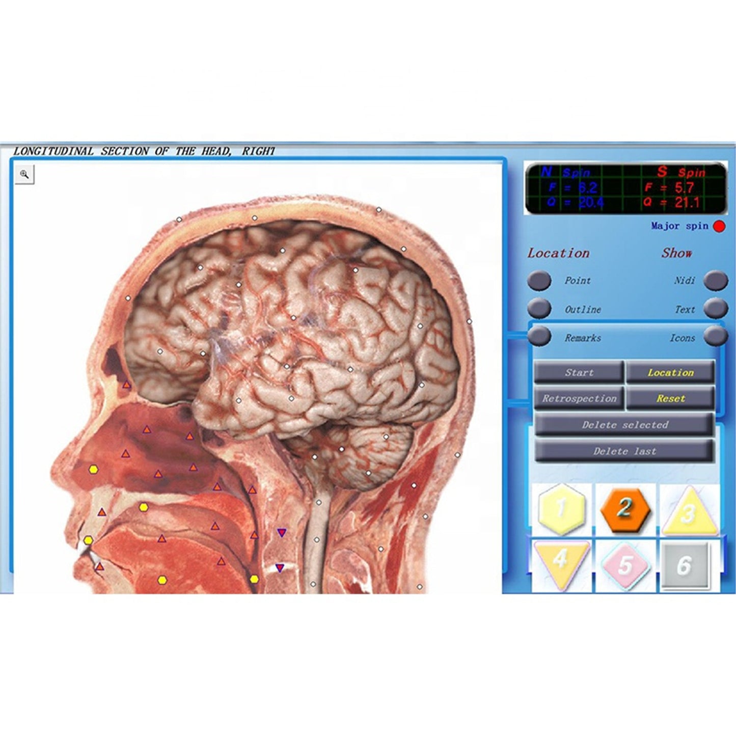 JYTOP Latest 3D-Cell Diagnostics Sub Health Analyzer Quantum Bioresonance Analyzer