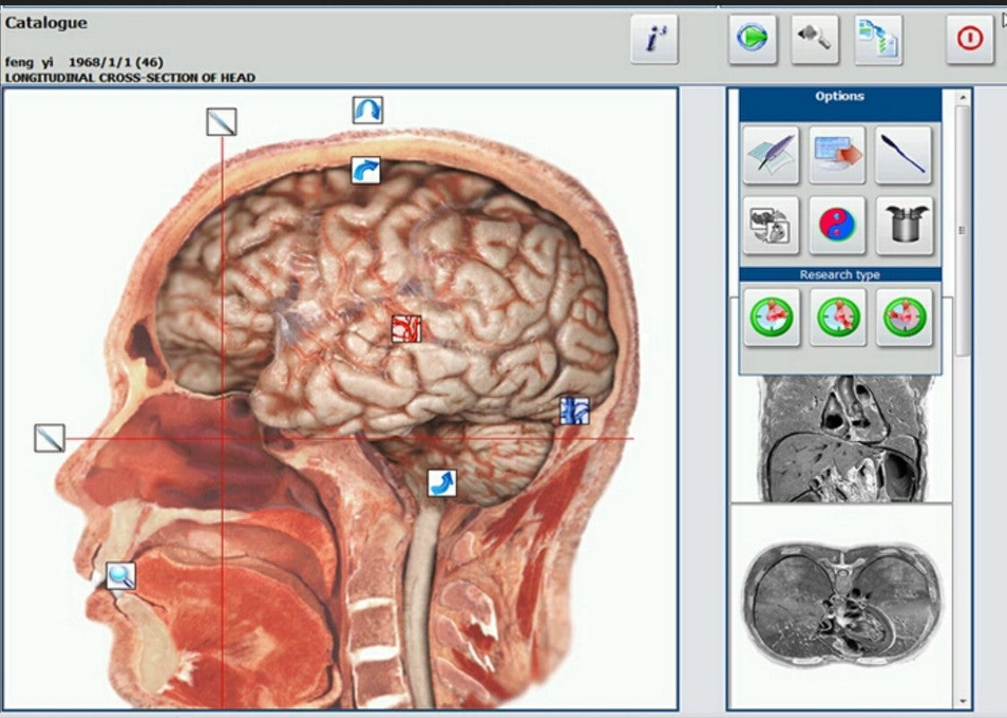 JYtop Metapathia GR Hunter 18D 4025 NLS Diagnose Bioresonanz Therapie evtl m Laptop Biosca