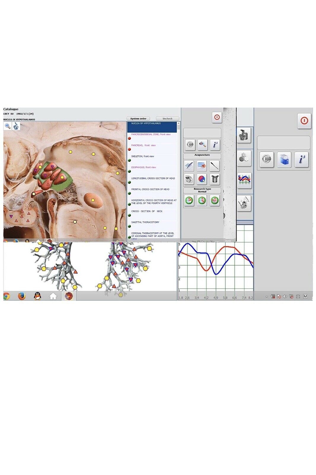 JYtop 18D Hunter 4025 Health Monitoring and Therapy - Metapathia GR Hunter NLS Bioresonance Diagnose Health Therapy System