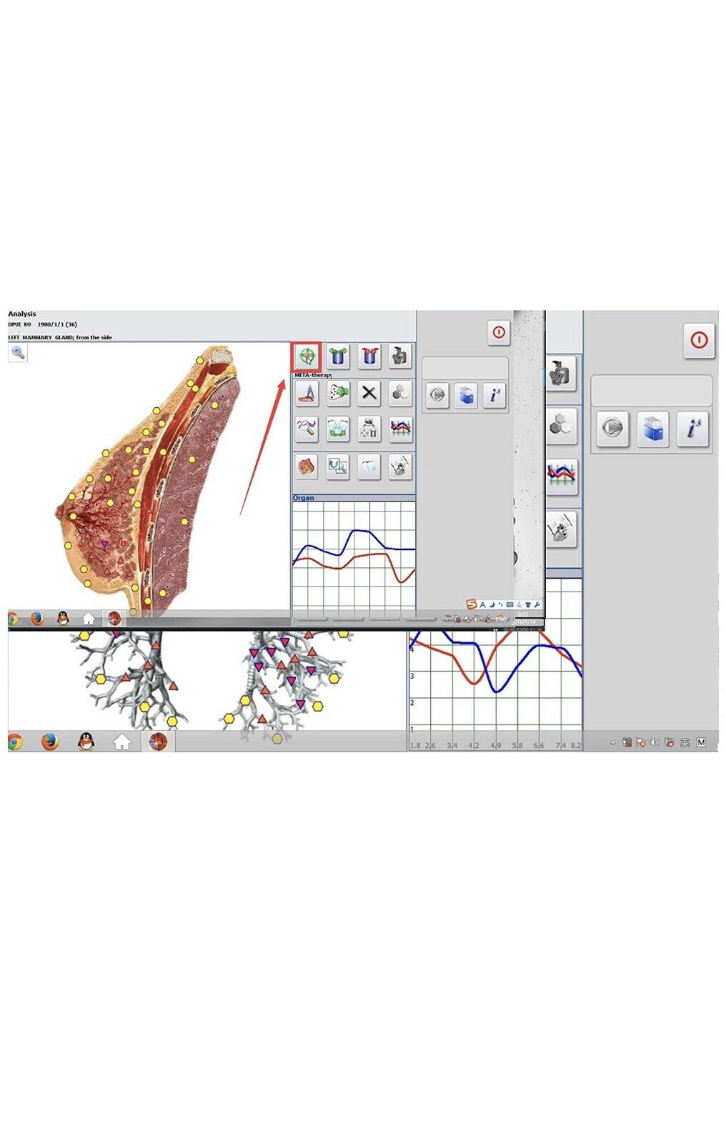 JYtop 18D Hunter 4025 Health Monitoring and Therapy - Metapathia GR Hunter NLS Bioresonance Diagnose Health Therapy System