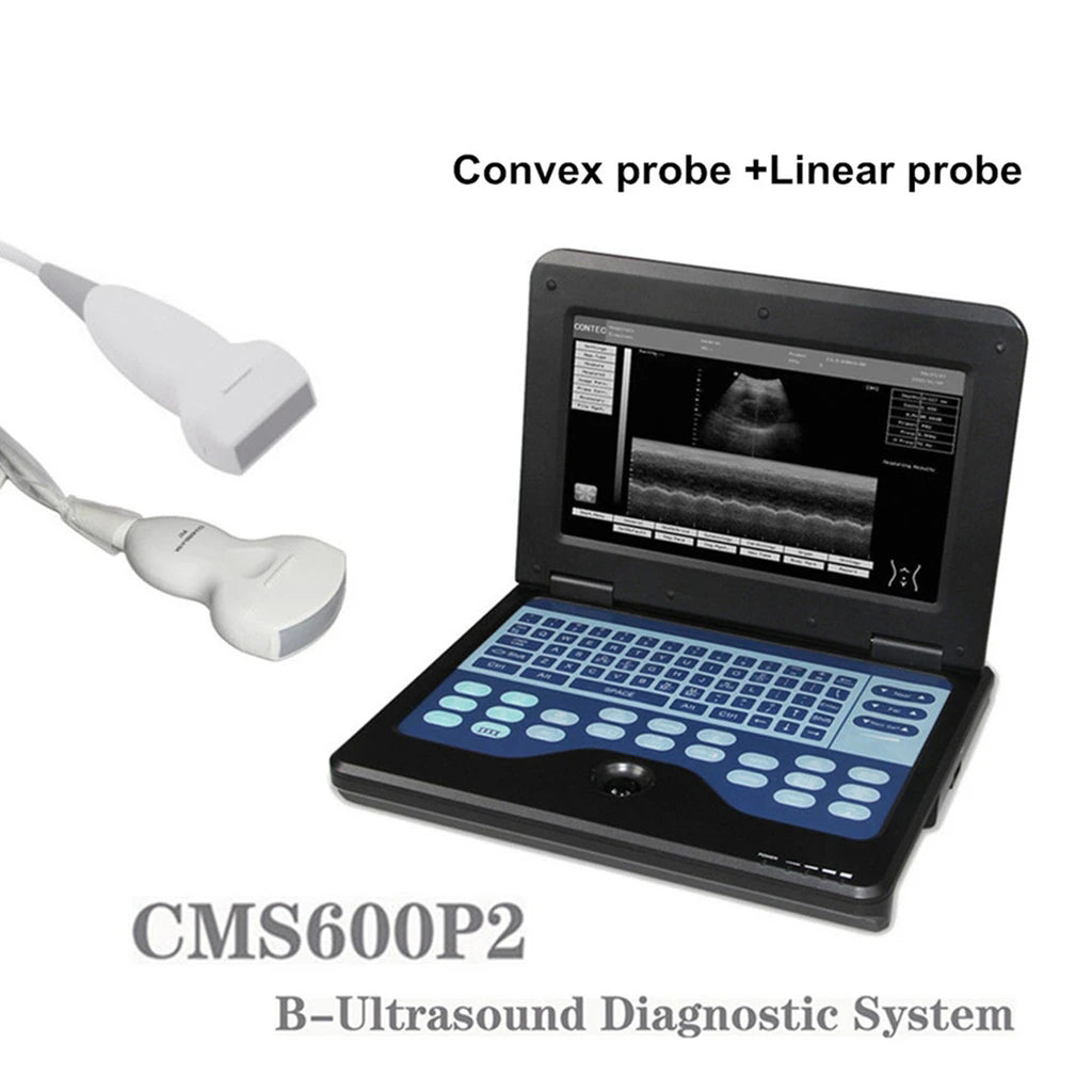 JYTOP Portable Laptop Machine Digital Ultrasound Scanner,7.5M Linear+3.5M Convex Probe