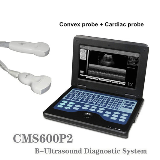 JYTOP Portable Laptop Machine Digital Ultrasound Scanner,3.5M Cardiac Probe+3.5M Convex Probe