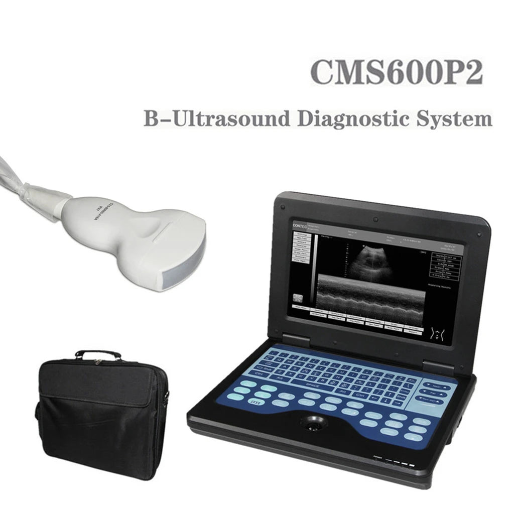 JYTOP Portable Laptop Machine Digital Ultrasound Scanner,3.5 Convex Probe CMS600P2