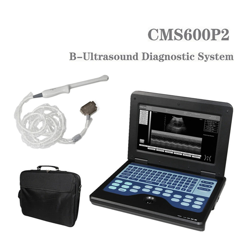 JYTOP Portable Laptop Machine Digital Ultrasound Scanner,6.5 MHz endo-vaginal probe CMS600P2