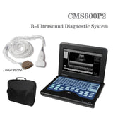 JYTOP Portable Laptop Machine Digital Ultrasound Scanner,7.5 MHZ Linear Probe CMS600P2
