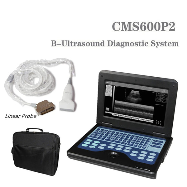 JYTOP Portable Laptop Machine Digital Ultrasound Scanner,7.5 MHZ Linear Probe CMS600P2