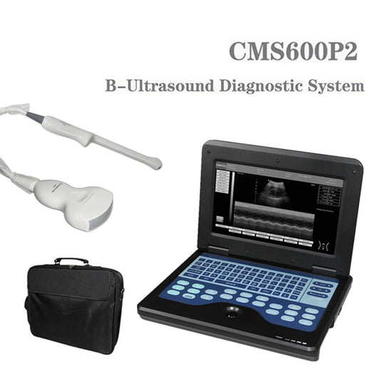 JYTOP Portable Laptop Machine Digital Ultrasound Scanner,2Probes Convex +endo-vaginal CMS600P2