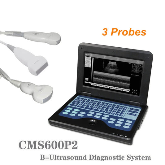 JYTOP Portable Laptop Machine Digital Ultrasound Scanner, Convex+Linear+Cardiac 3 Probes