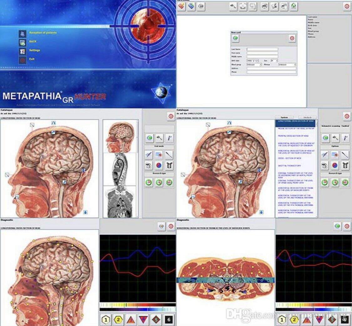 JYtop 18D Hunter 4025 Health Monitoring and Therapy - Metapathia GR Hunter NLS Bioresonance Diagnose Health Therapy System