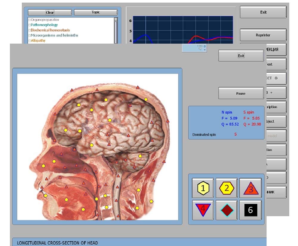 JYtop Latest 9D NLS CELL Diagnostics Bioresonance Sub Health Analyzer Diacom Quantum