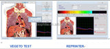 JYTOP Clinical analytical instruments bioresonance scanner 9d lris nls iris- nls