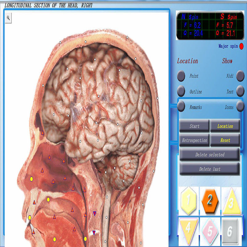 JYtop Bioresonance Therapy Device 3D NLS Health Analyzer Equipment 3D NLS Analyzer with Original Software