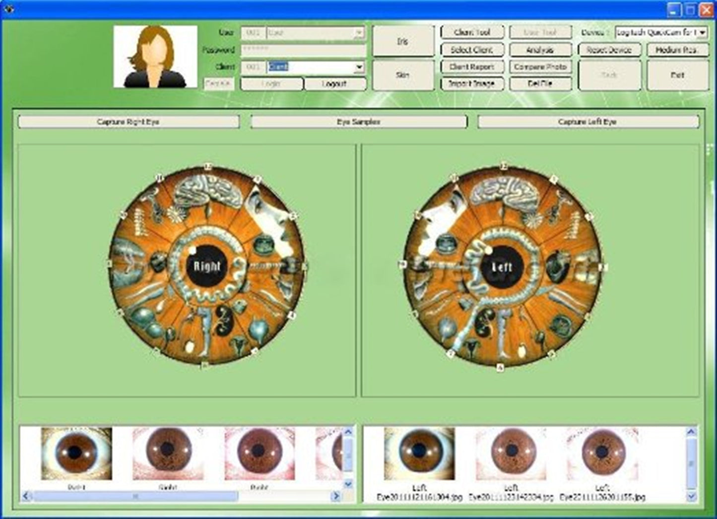 Free shipping!!! JYTOP 500 MP 4 LED /2 LED DigitaI Iriscope Iridology USB camera Iris analyzer EH660U