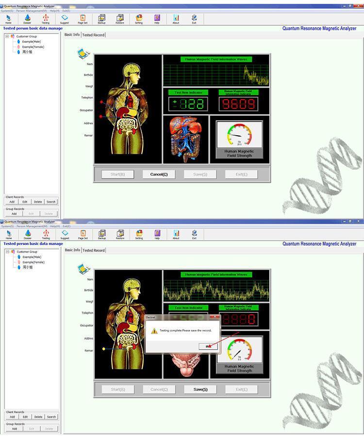 JYtop 2ND Quantum Resonance Magnetic Analyzer Body Healther Analyzer