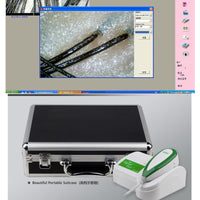 JYtop 5.0M Pixels USB Left/Right lamp Iriscope Iridology Camera with Pro Software 900U Hair Camera Hairscope Hair Analyzer Hair Scope Hair Diagnosis