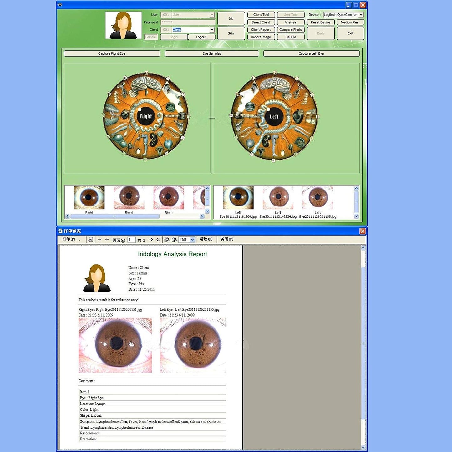 JYtop NEW 5.0 MP USB Eye Iriscope,Iris Iridology camera 990U with Pro Software, FCC,CE EH990U