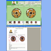 JYtop NEW 5.0 MP USB Eye Iriscope,Iris Iridology Skin Hair camera 990U with Pro Software, FCC,CE EH990U