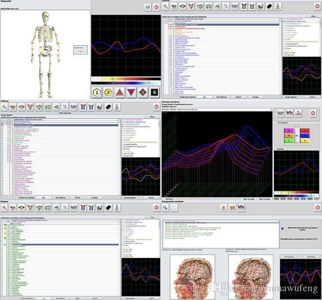 JYTop New Bio Resonance system Hunter 4025 NLS with Metapathia GR Software